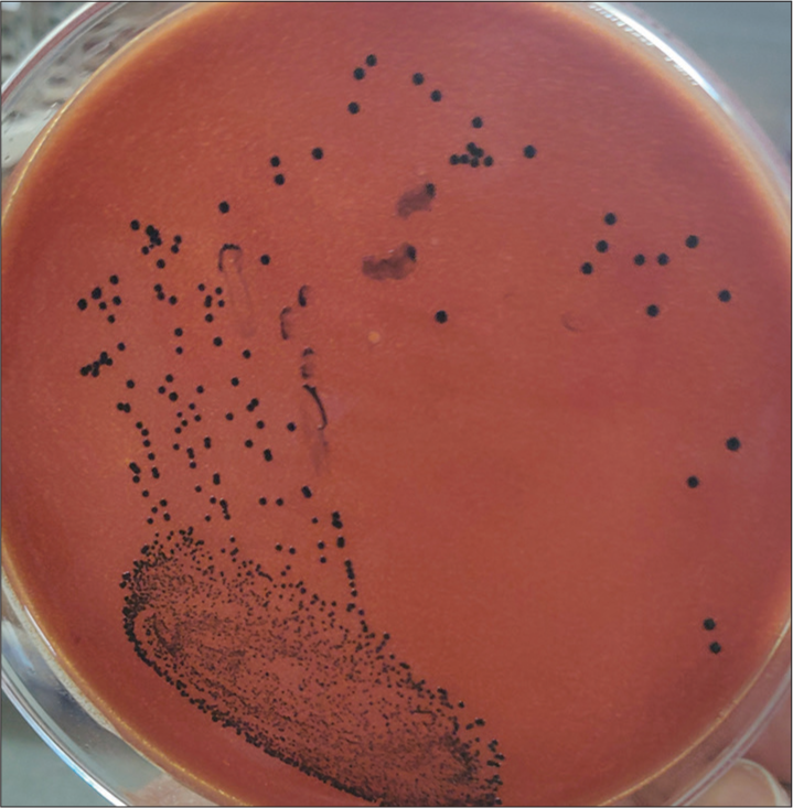 Black colonies of Corynebacterium diphtheriae on potassium tellurite agar.