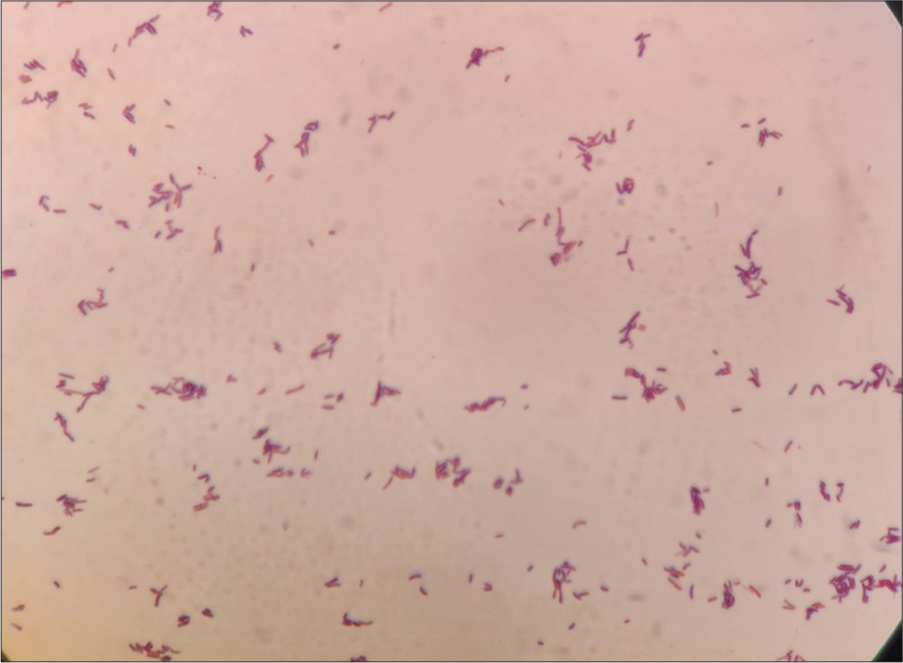 Gram stain from the colonies showed Gram-positive bacilli in cuneiform arrangement.