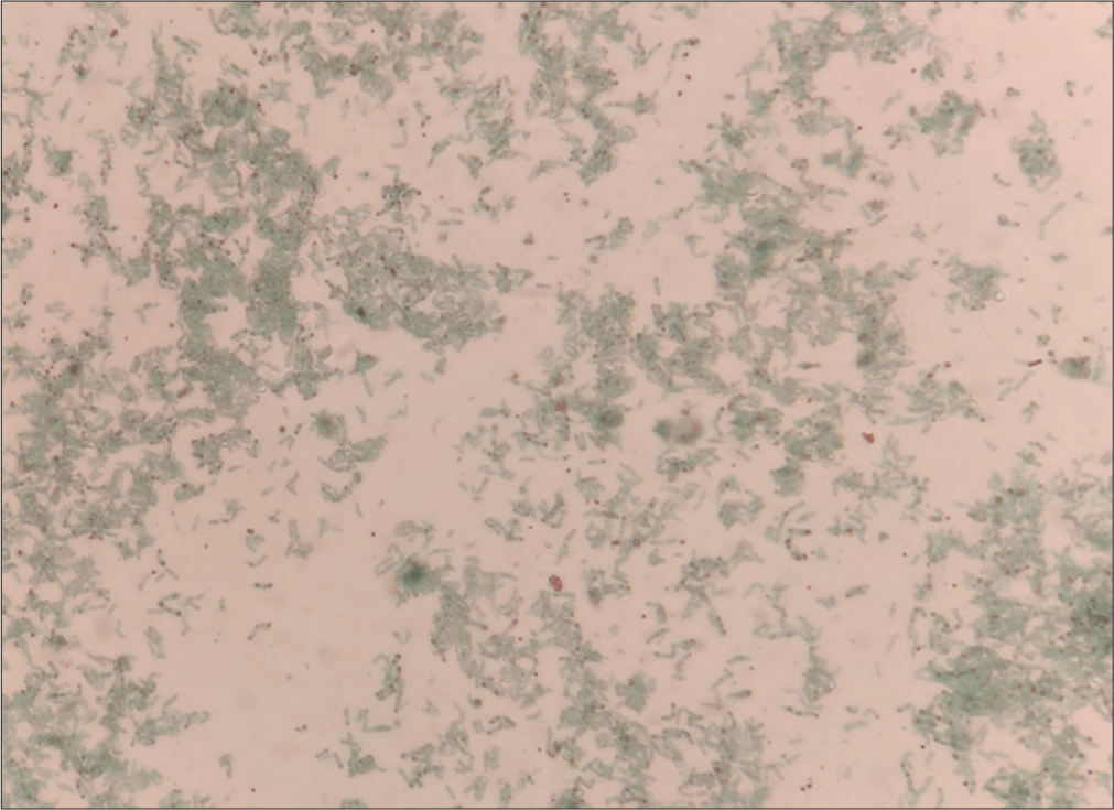 Albert stain from the colonies showed green-colored bacilli with bluish-purple metachromatic granules.