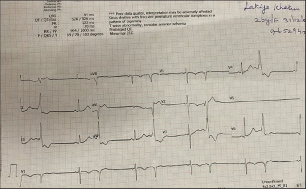 Electrocardiography showed ventricular premature ectopics.