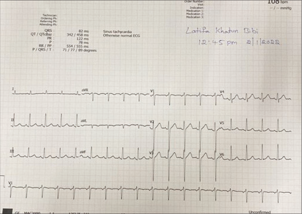 Electrocardiography showing sinus rhythm.