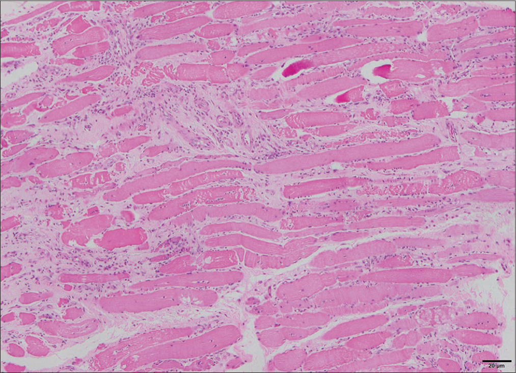 Muscle biopsy with H&E paraffin sections. H&E: Haematoxylin and eosin stain.